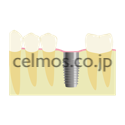 dental image
