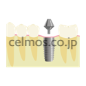dental image