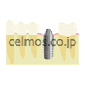 dental image